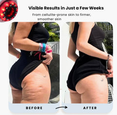Rêvassoir SculptGlow™ PRO