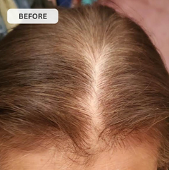 Rêvassoir Hair Growth Laser Cap