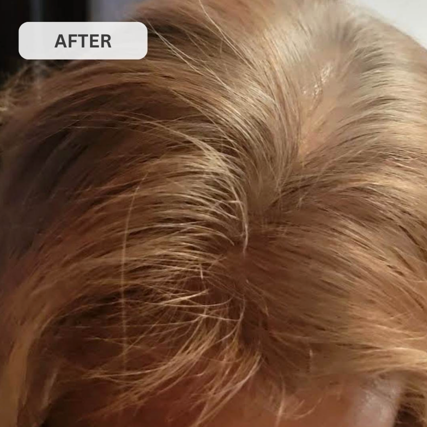 Rêvassoir Hair Growth Laser Cap