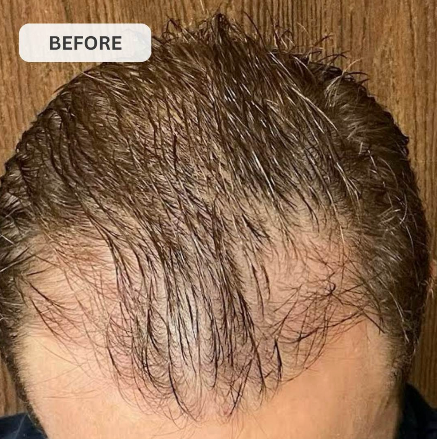 Rêvassoir Hair Growth Laser Cap