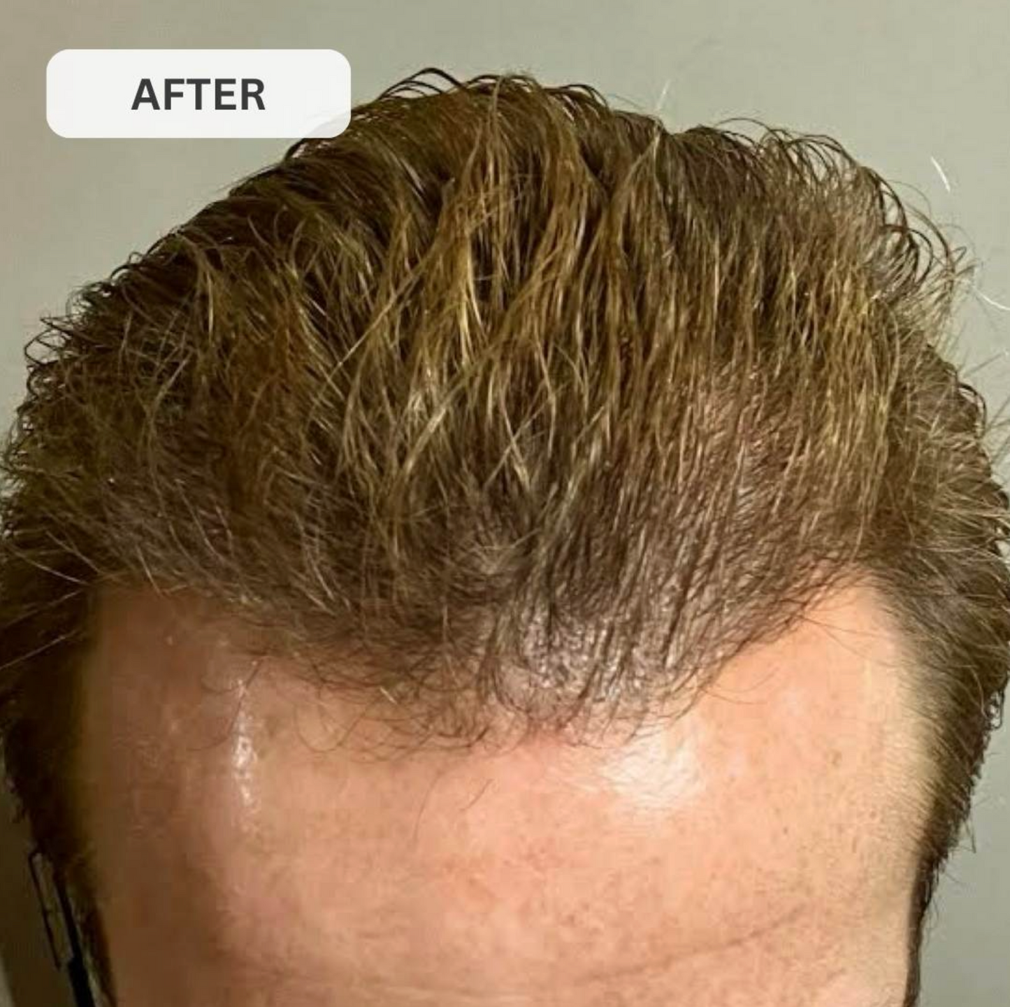Rêvassoir Hair Growth Laser Cap